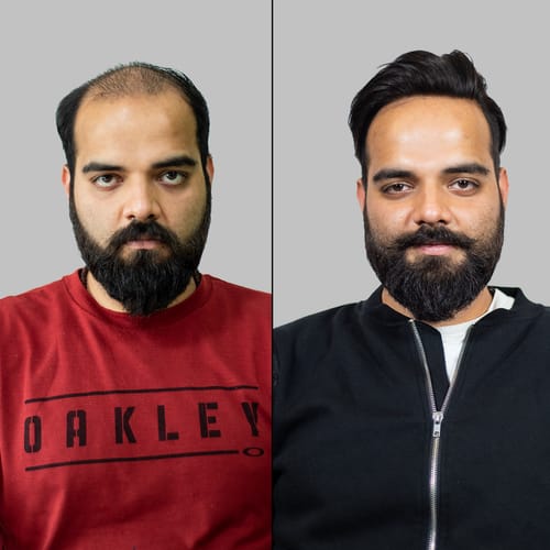Transformation 4